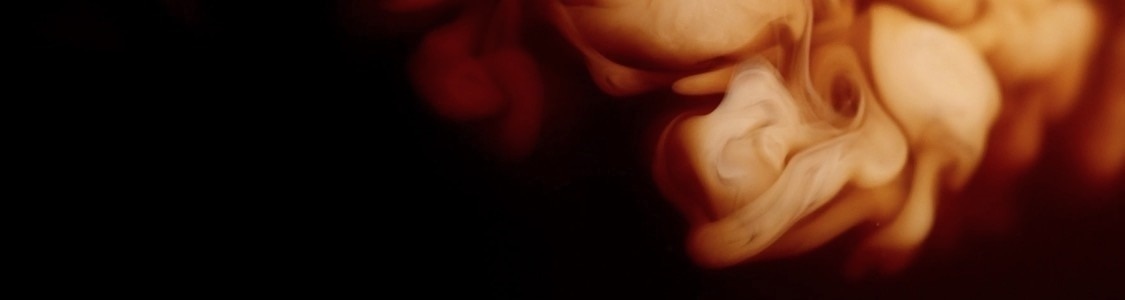 라테 banner